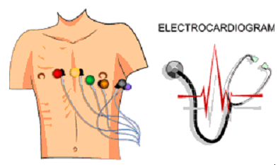 EKG leads